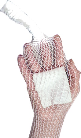 DEROYAL STRETCH NET™ TUBULAR ELASTIC BANDAGE (SUGGESTED APPLICATION - CHEST, AXILLA, ABDOMEN) (PACKAGING - EACH)