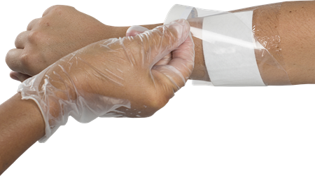DEROYAL TRANSEAL® PLUS TRANSPARENT DRESSING WITH ABSORBENT PAD (QTY/BOX - 25) (PACKAGING - CASE OF 100)
