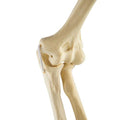 ORTHObones Standard Elbow elastic bands r