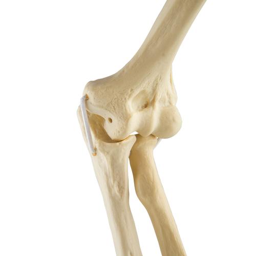 ORTHObones Standard Elbow elastic bands r