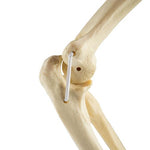 ORTHObones Standard Elbow elastic bands r
