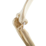 ORTHObones Standard Elbow elastic bands l