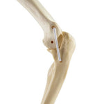 ORTHObones Standard Elbow elastic bands l
