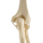 ORTHObones Standard Elbow elastic bands l