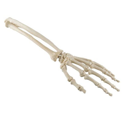 ORTHObones Standard Hand & wrist