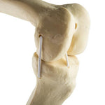 ORTHObones Standard Knee left