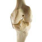 ORTHObones Standard Knee left