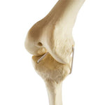 ORTHObones Standard Knee left