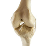 ORTHObones Standard Knee left