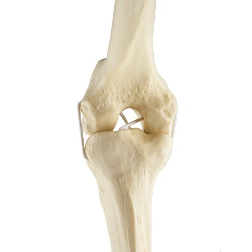 ORTHObones Standard Knee left
