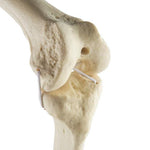 ORTHObones Standard Knee right