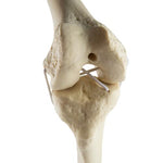 ORTHObones Standard Knee right
