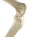 ORTHObones Standard Knee right