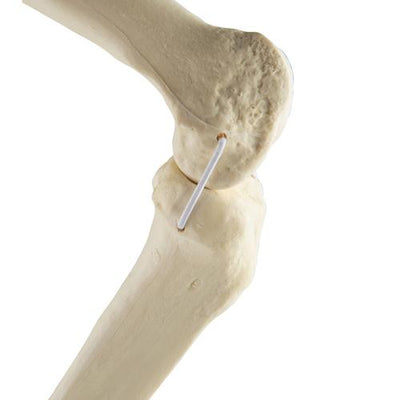 ORTHObones Standard Knee right