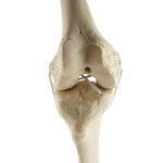 ORTHObones Standard Knee right