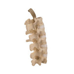 ORTHObones Standard Lumbar Spine