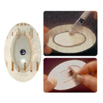 Patterson Med(Sammons Preston) Electrode Iontophoresis Iomed Iogel 11-1/10x11-1/10cm Md Gl/Spng/Ag/AgCl 12/Pk - 2971