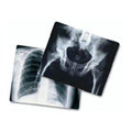 Medlink Imaging Film X-Ray Radiomat Mplu 8x10" 100/Bx - 3XA3C