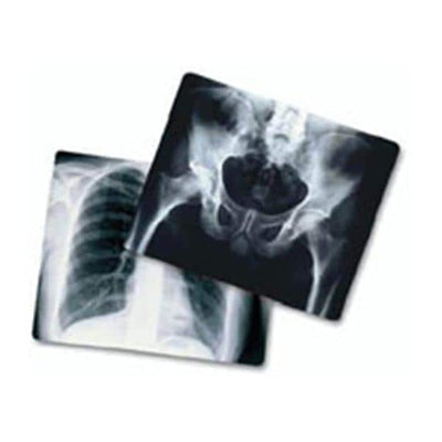 Medlink Imaging Film X-Ray Radiomat Mplu 8x10" 100/Bx - 3XA3C