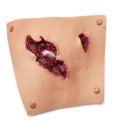 Nasco Healthcare, Inc Moulage Training Compound Fracture Femur Upper Leg Each - 800-6819