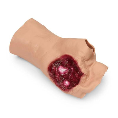 Nasco Healthcare, Inc Moulage Training Gunshot Wound Palm Each - 800-6881