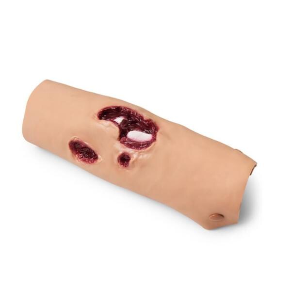 Nasco Healthcare, Inc Moulage Training Compound Fracture Tibia Lower Leg Each - 800-6761