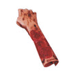 Nasco Healthcare, Inc Moulage Training 2nd & 3rd Degree Burn of Forearm Each - 800-6802