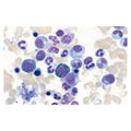 Richard Kwik-Diff Differential Stain Kit Reagents 1,2,3 500mL 1/Kt - Allan Scientific - 9990700