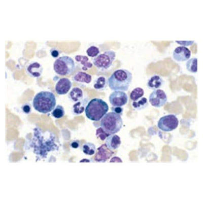 Richard Kwik-Diff Differential Stain Kit Reagents 1,2,3 500mL 1/Kt - Allan Scientific - 9990700