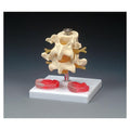 Wolters Kluwer Health Inc Lumbar Vertebrae Model Anatomical Budget Each - CH76