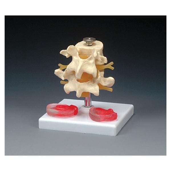 Wolters Kluwer Health Inc Lumbar Vertebrae Model Anatomical Budget Each - CH76