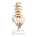 Wolters Kluwer Health Inc Lumbar Vertebral Column Model Anatomical Adult Each - A74