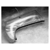 Allied Health Care Prod Splint Kit Air Schuco Vinyl 4-Piece Kit Arm/Leg Translucent White 4/Pk - S530