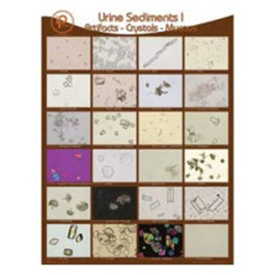 Indiana Pathology Images Poster Wall Urine Sediments 18x24" Each - 1887