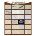 Marketlab Poster Wall Urine Sediments II 19x24" Each - 1888