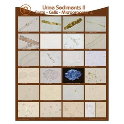 Marketlab Poster Wall Urine Sediments II 19x24" Each - 1888