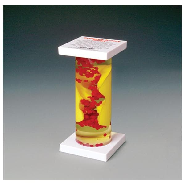 Wolters Kluwer Health Inc Occluded Artery Model Anatomical Each - 79145