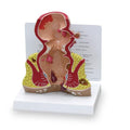Nasco Healthcare, Inc Rectum Model Anatomical 1-1/2 Life-Size Each - SB35433