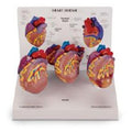 Nasco Healthcare, Inc Mini Heart Model Anatomical 3/St - SB44893
