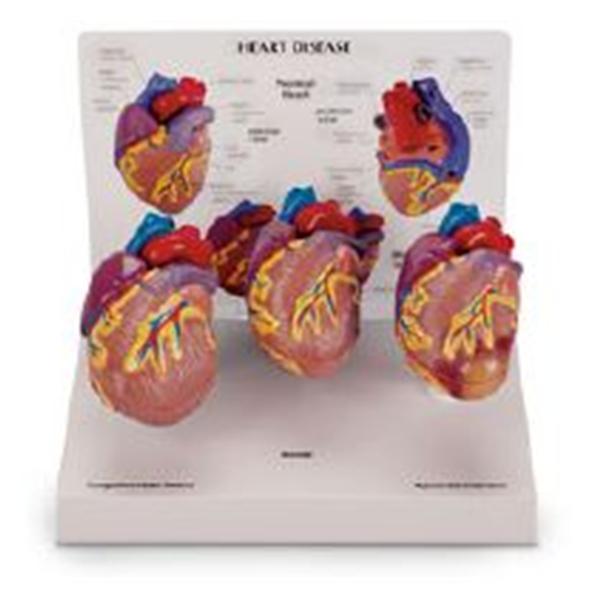 Nasco Healthcare, Inc Mini Heart Model Anatomical 3/St - SB44893