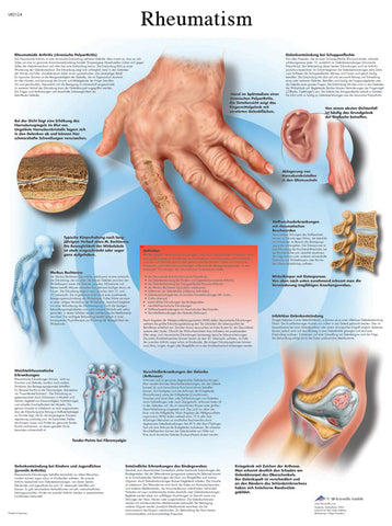 Anatomical Chart - rheumatic diseases, paper 