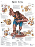 Anatomical Chart - sports injuries, laminated 
