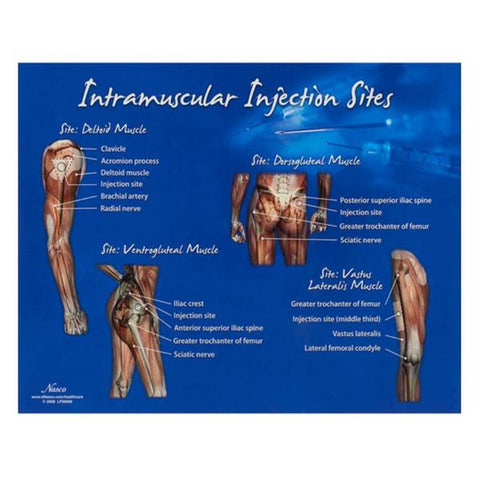 Nasco Healthcare, Inc Chart Training Intramuscular Injection Sites 10-1/2x14" Each - LF00696