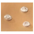 Avanos Medical Set Gastrointestinal Anchor SAF-T-PEXY Each - 98701