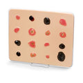 Nasco Healthcare, Inc Enlarged Skin Cancer Trainer Educational Life/form Each - LF00950