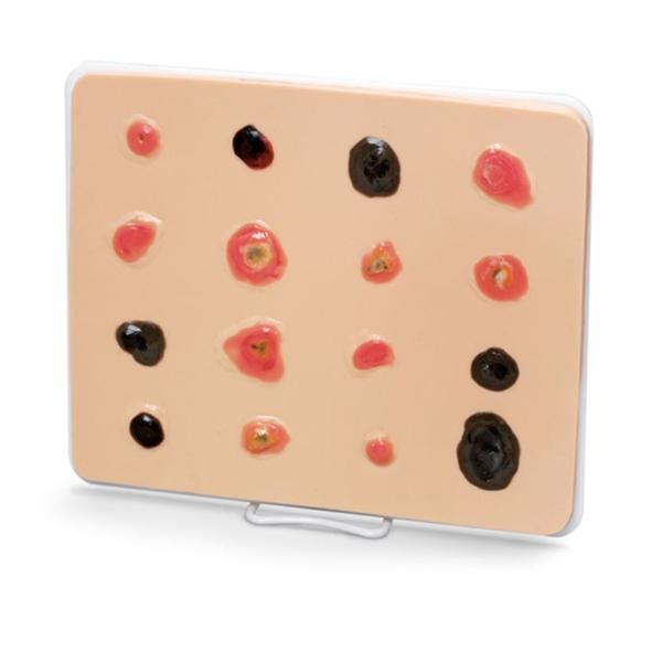Nasco Healthcare, Inc Enlarged Skin Cancer Trainer Educational Life/form Each - LF00950