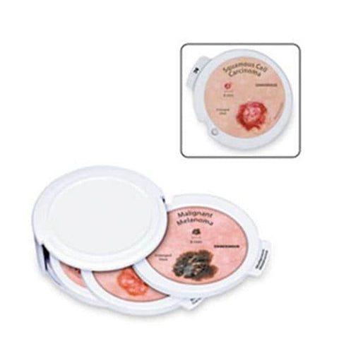 Nasco Healthcare, Inc Skin Cancer Disk Set Educational Each - SB47381