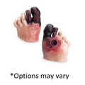Nasco Healthcare, Inc Unhealthy Foot Care Model Kit Anatomical Life/form Each - WA21216