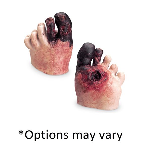 Nasco Healthcare, Inc Unhealthy Foot Care Model Kit Anatomical Life/form Each - WA21216