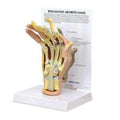 Wards Natural Science Model Rheumatoid Arthritis Hand GPI Anatomicals Each - 470160-248